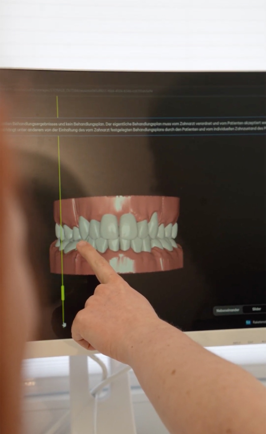 3D-Scan und digitaler Behandlungsplan im Behandlungszimmer
